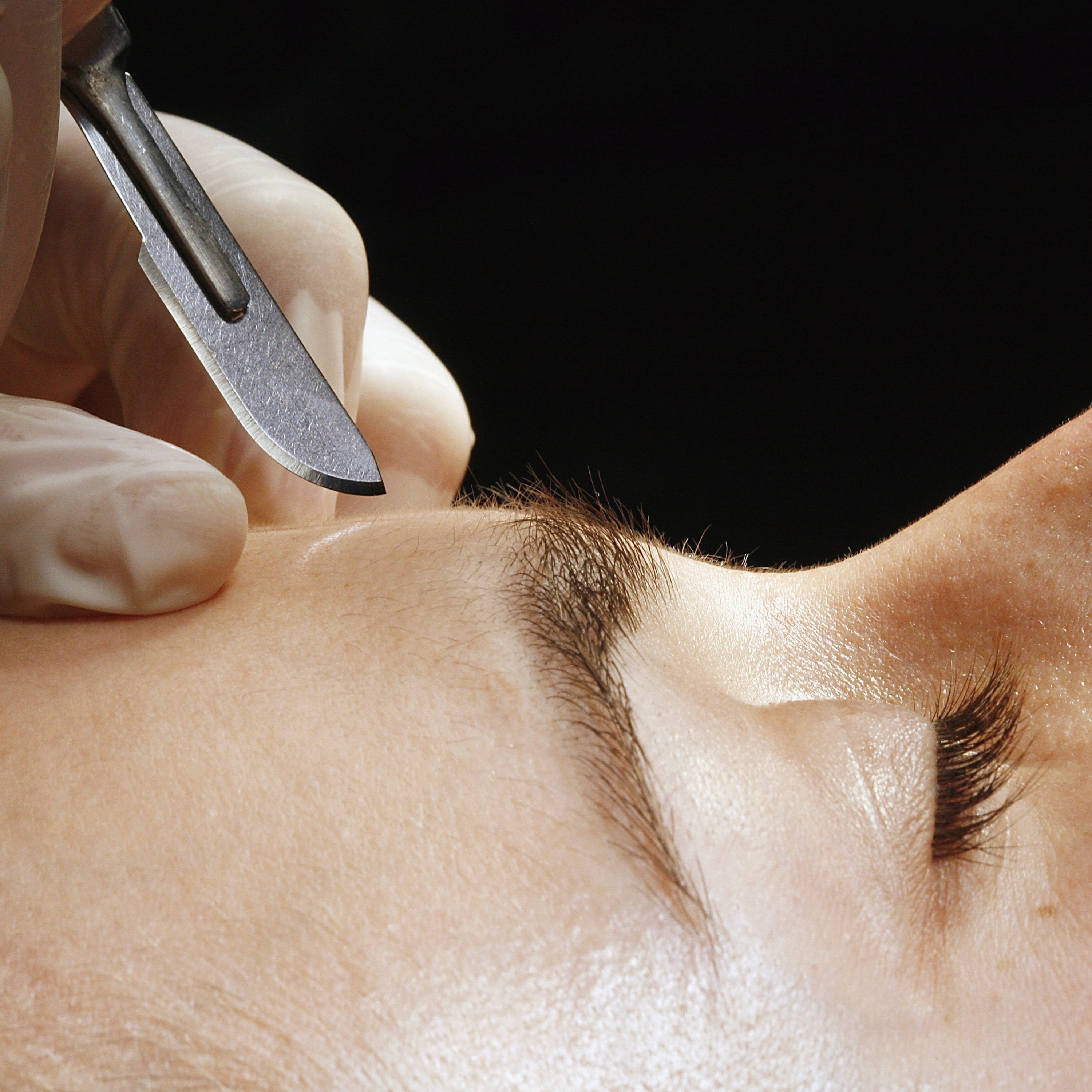 The real reason so many people are getting cosmetic surgery