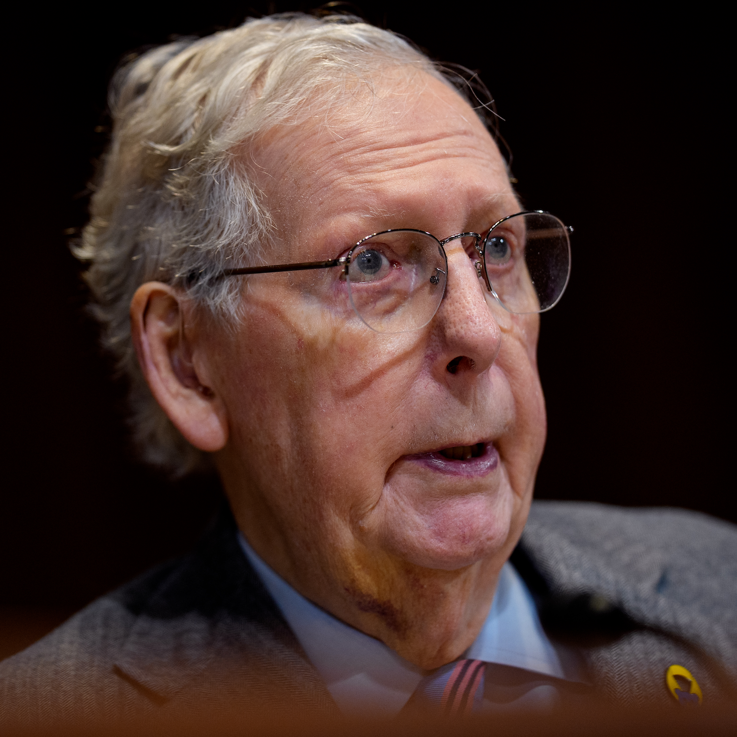 The mystery surrounding Mitch McConnell’s absence
